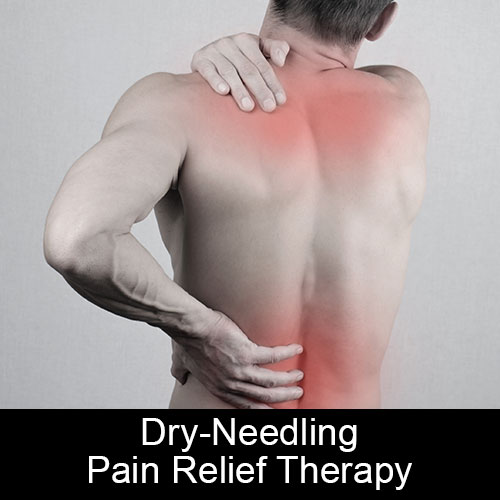 Dry-Needling Pain Relief Therapy