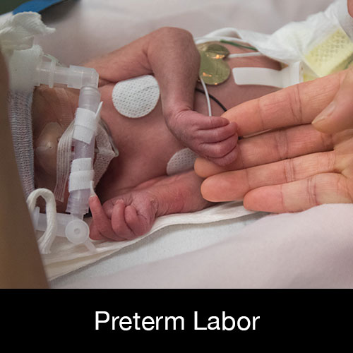 Preterm Labor